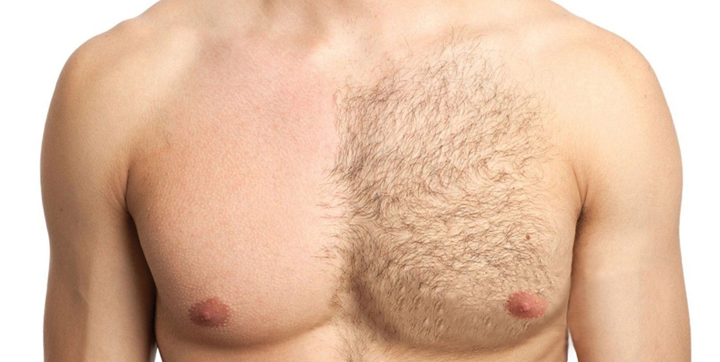 эпиляция груди мужчины цена (120) фото